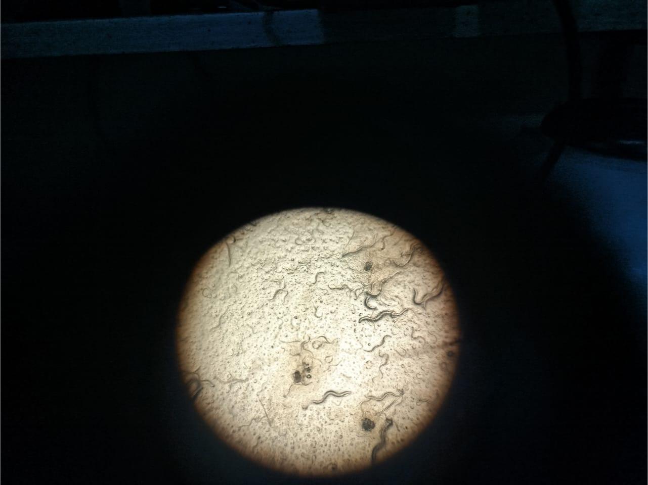 C. elegans worms seen through the microscope